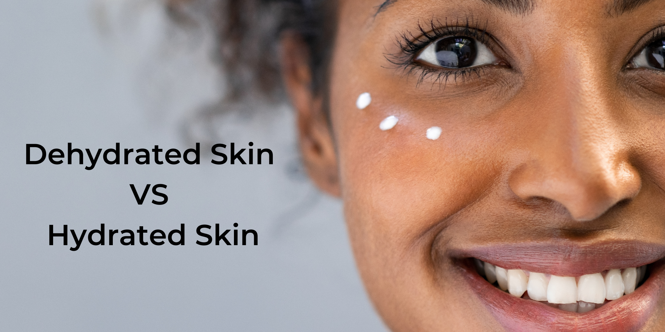 Dehydrated skin vs Hydrated skin