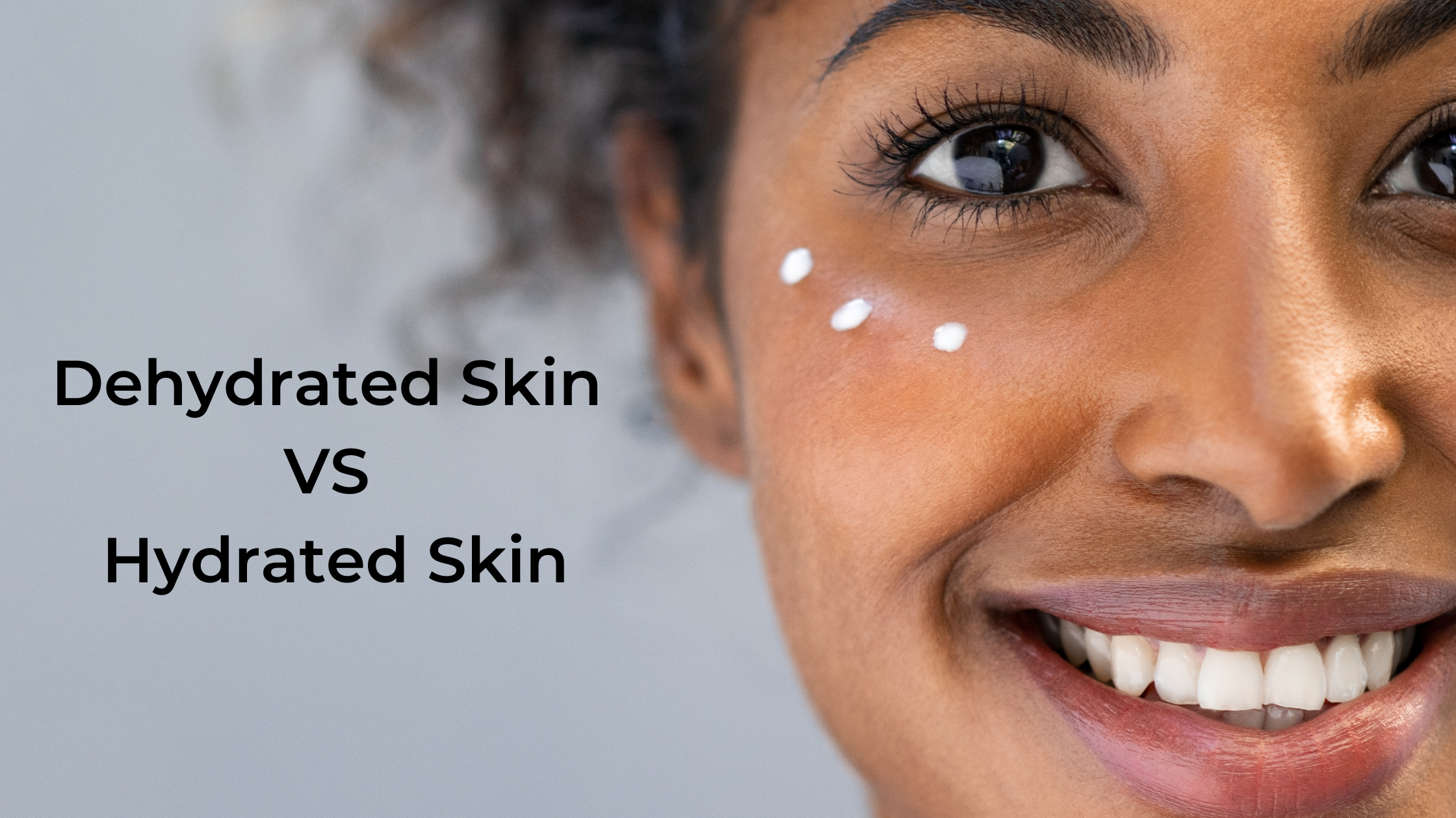 Dehydrated skin vs Hydrated skin
