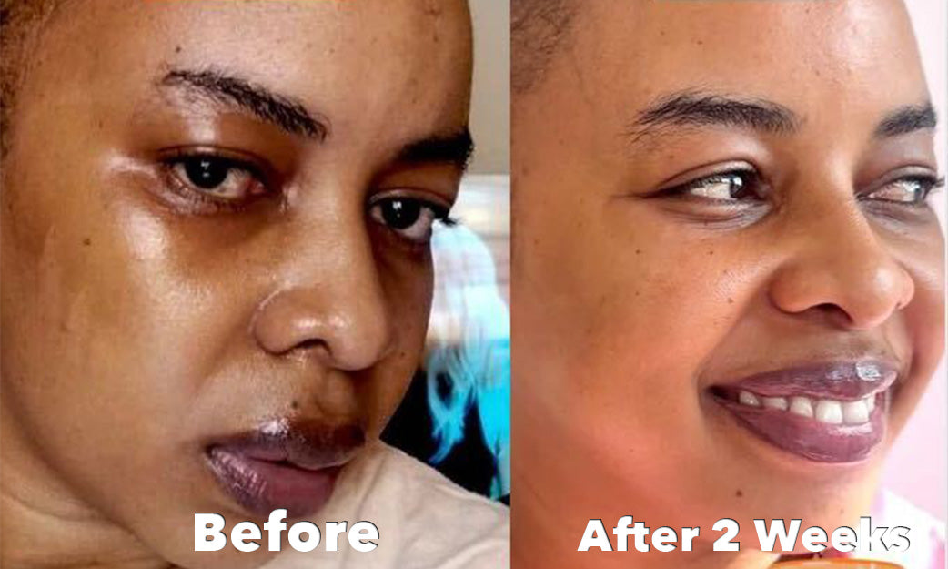 Before and After