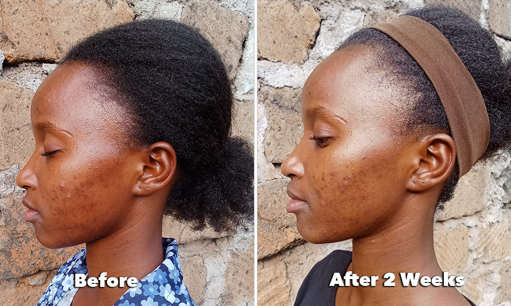 Before and After
